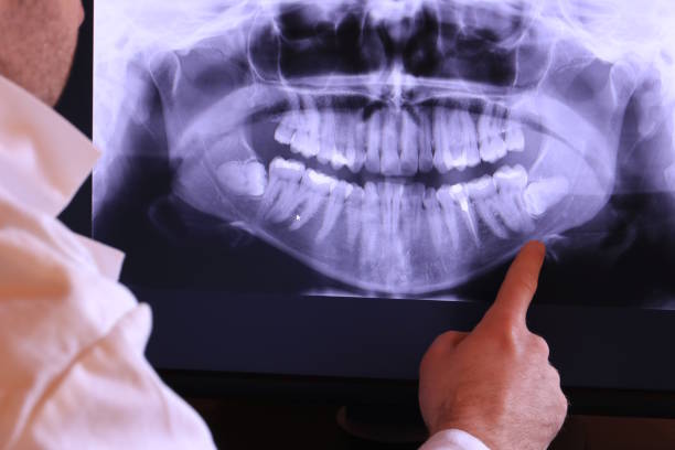 Best Emergency Gum Treatment in Hartford, SD